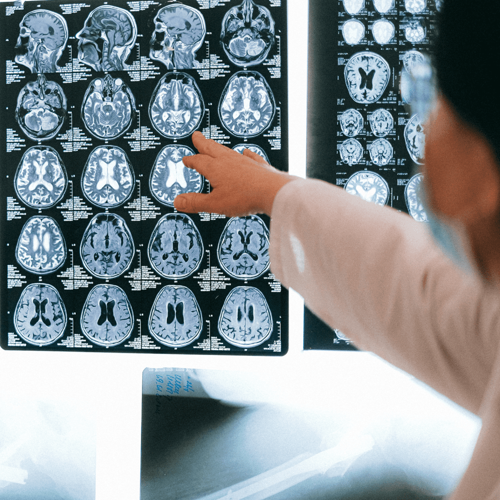 Doctor viewing brain scans